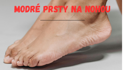 Modré prsty na nohách: Príčiny, prevencia a liečba | ARNO-obuv.sk - obuv s tradíciou